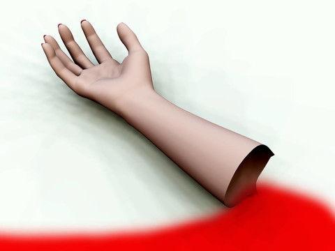 肩膀出血的照片,肩膀出血现场纪实